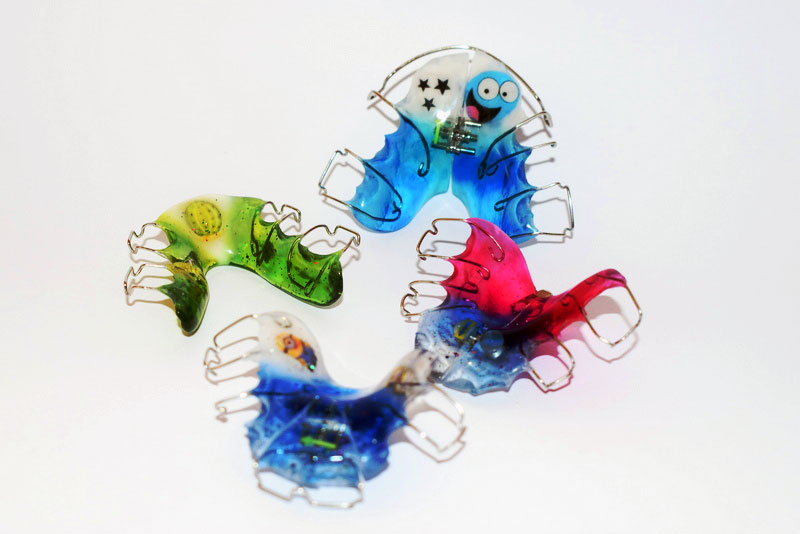 Examples of removable appliances