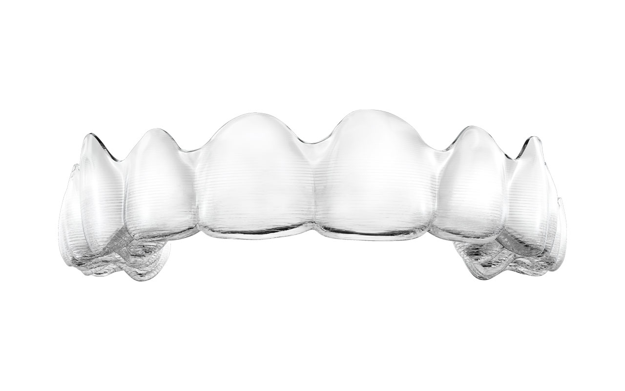 Invisalign Aligners