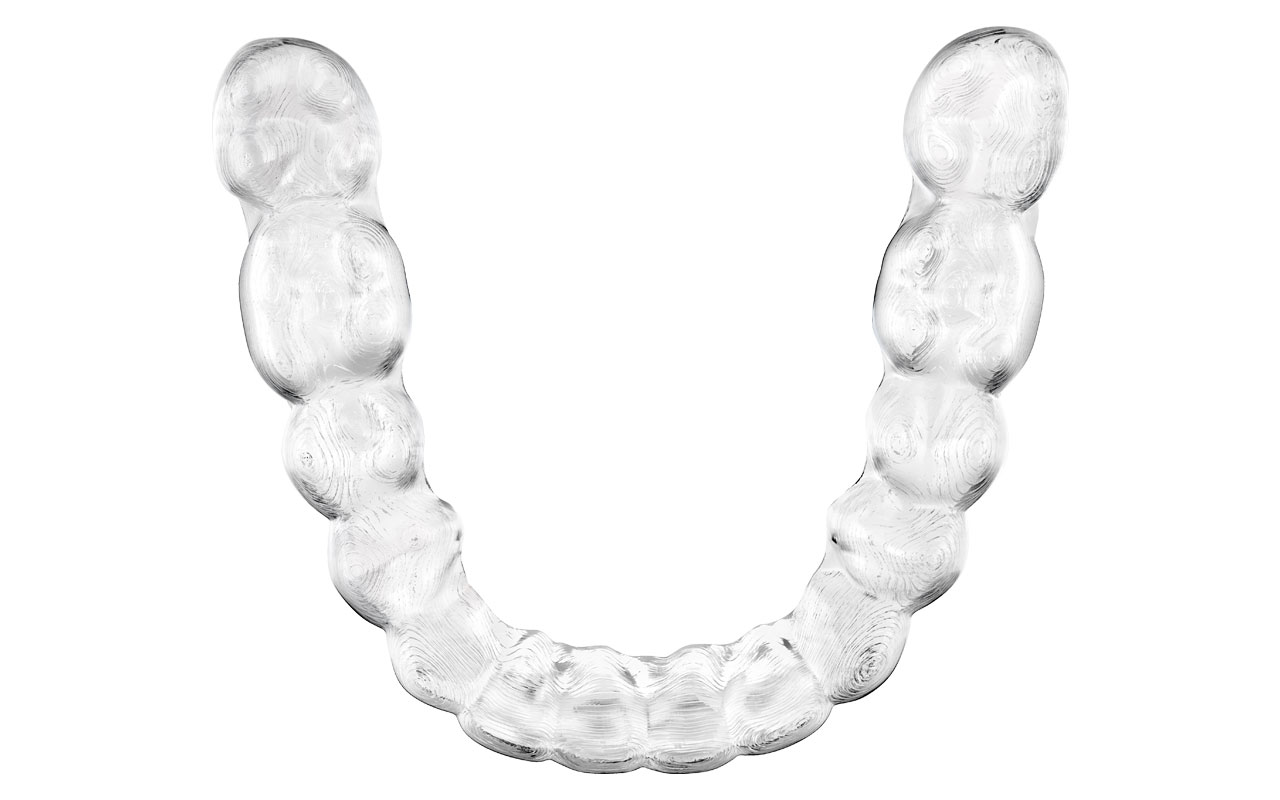 Invisalign Aligners