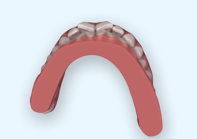 12A