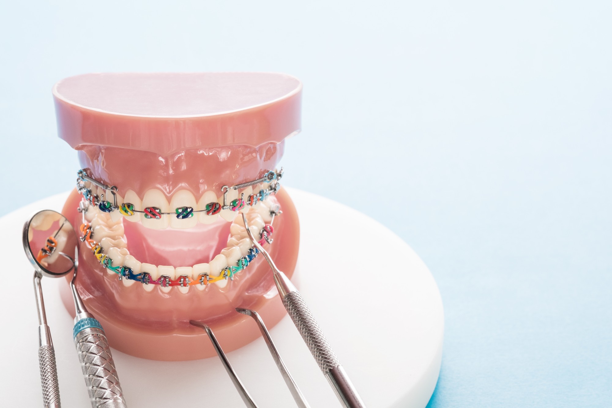 aparat ortodontyczny