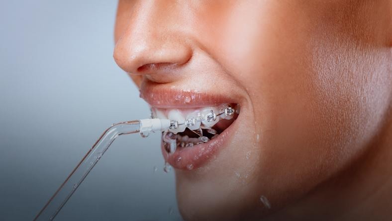 Irygator - czyszczenie zębów z aparatem